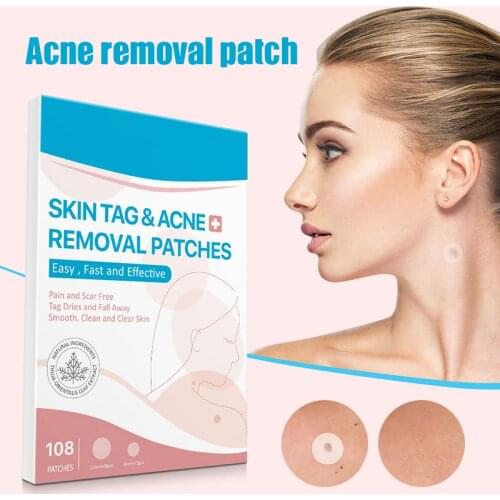 108pcs Skin Tag Removal Patches Skin Tag Removal Remover Skin Care Tool Foot Patch Removal With Cotton Swab Skin Care -VL16