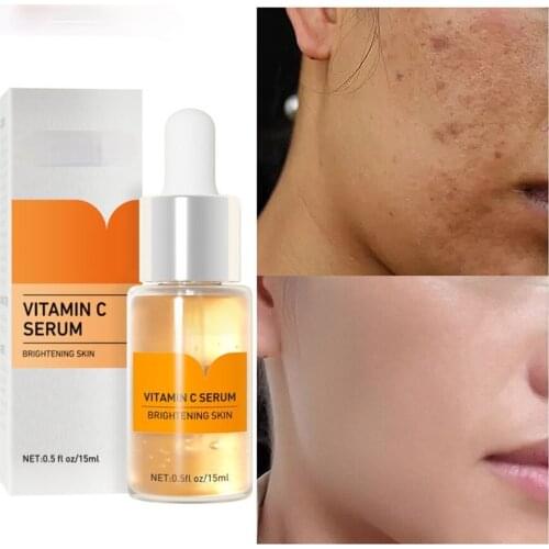 KAPOMI Whitening Face Serum