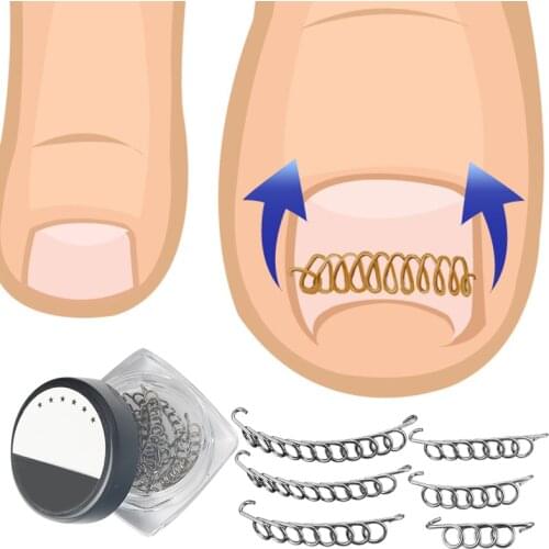 12pcs Ingrown Toe Nail Correction Wire Fixer Pedicure Paronychia Recover Toenails Corrector Foot Care Tool