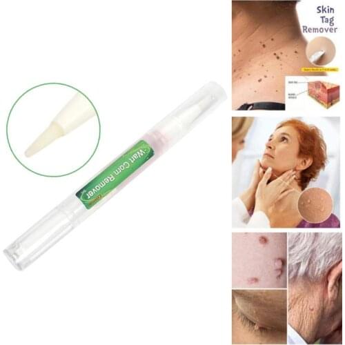 3ML Tags Moles Remover Liquid Pen Spots Removal Pen Anti Varicose Spider Vein Eraser Treatment Liquid Wart Remover TSLM1