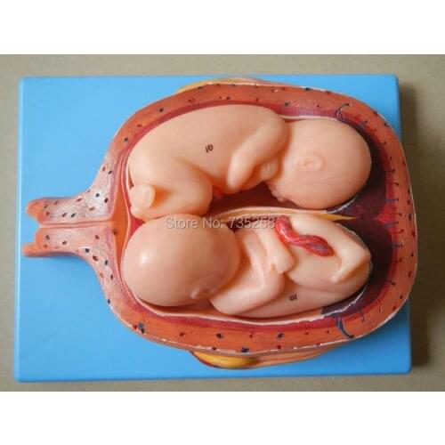 Five Months Pregnant Twins Model,Twins Fetuses Model,20 Weeks Twins Fetuses Model,Fifth Month Twins Pregnancy