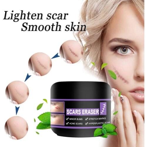 10g/20g/30g/50g Scar Cold Compress gel Scar Removal Cream Acne Corrector Burn Marks Stretch Pigmentation Хирургический Scars Gel
