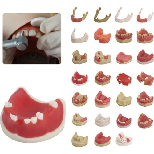 Dental materials dental model oral implant surgery maxillary sinus dental supplies equipment tools soft gums