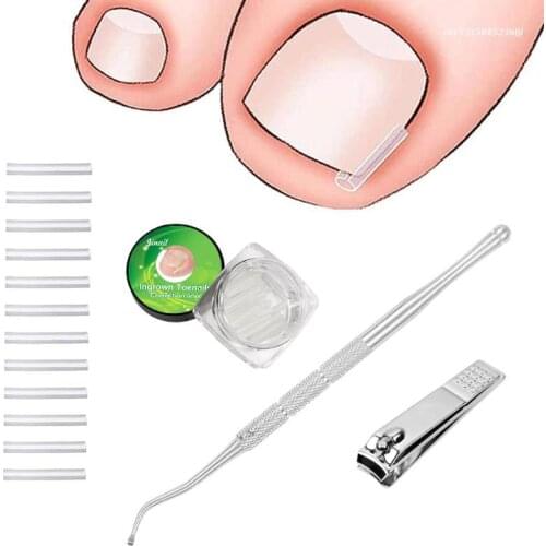 Ingrown Toenail Corrector Straightener Strips with Lifter Nail Clippers New
