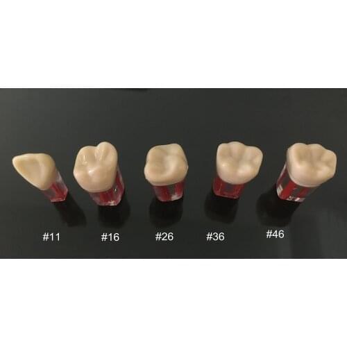 5pcs Dental Root Canal Teeth Study Practice Model for Endodontic Pulp File #11/16/26/36