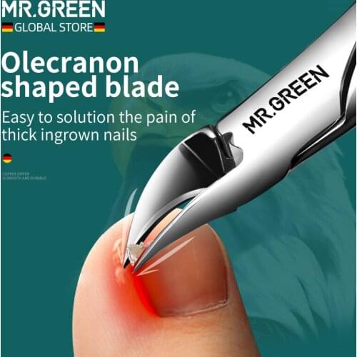 MR.GREEN Nail Clippers Ingrown Toenail Cutters Pedicure Tools Anti-Splash Olecran Podiatry Paronychia Correction Manicure tool