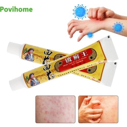 1Pcs 20g Antibacterial Antipruritic Ointment Psoriasis Eczema Dermatitis Treatment Cream Anti-Itching Herbal Medical Plaster