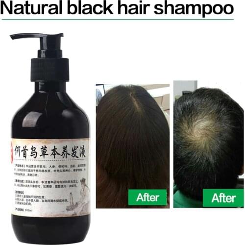 Herbal Natural Polygonum Multiflorum Shampoo Plant Liquid Grey Hair White Hair Removal Turn Permanent Black Hair Care 300ml