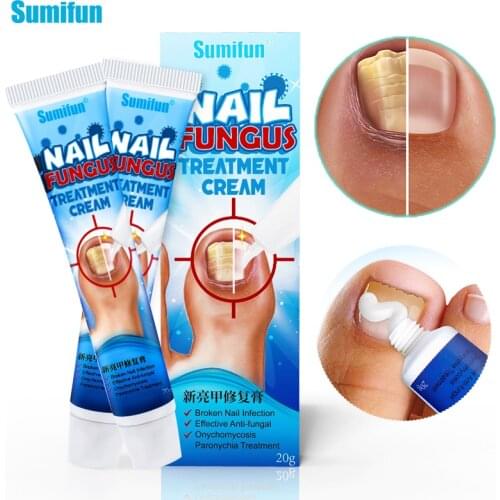 1Pcs 20g Nail Repair Cream Antibacterial Onychomycosis Paronychia Treatment Ointment Fingers Feet Whitening Care Nail Growth