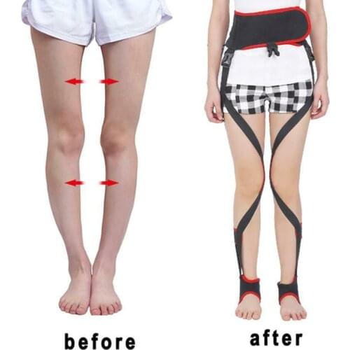 Adjustment Adult Unisex O-leg X-leg Figure Correction Belt Strap Slim Legs Tool Strap Black Personal Health Care TK-ing
