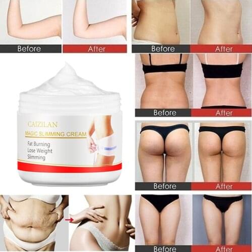 Enzyme Gentella Slimming Cream Reduce Cellulite Lose Weight Burning Fat Health Care Cream 30g