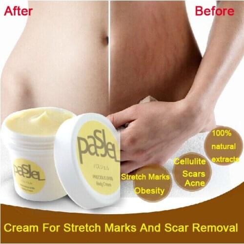 4PCS/LOT Pasjel Cream For Stretch Marks And Scar Removal Powerful To Maternity Skin Body Repair