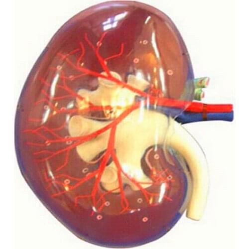 Internal renal artery distribution and coronary section model transparent kidney model medical teaching model