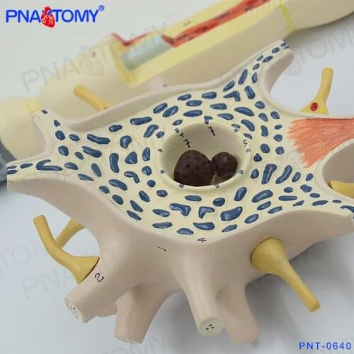 2500 Times Enlarged Human Neuron Model Nervous System Medical Science Anatomy Model Science Lab Tools