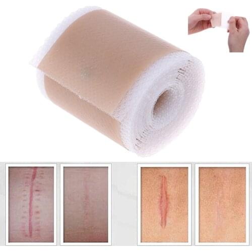 3.5x120cm Efficient Surgery Scar Removal Silicone Gel Sheet Therapy Patch for Acne Trauma Burn Scar Skin Repair Treatment