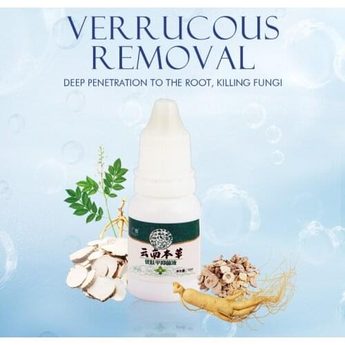 Skin Warts Fluid Thorn Treatment Remover Removal Fungi Verruca Corn Antibacterial Herb Ingredients Pain Relief Recovery Set/10ml