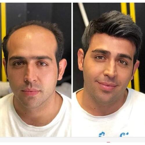 BYMC Black Toupee Men Brazilian Human Hair lace+weft base Replacement System Male Wig For Handsome Man