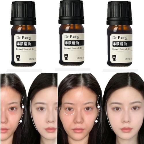 Feng temples, full forehead, remove bags under the eyes, decree lines, tear grooves, repair facial depressions, fill artifacts