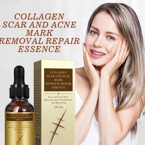 Imprint Repair Fluid Nourishing Skin Lightening Pigment Acne Marks Scars Remover Creams Strentch Marks Scar Removal