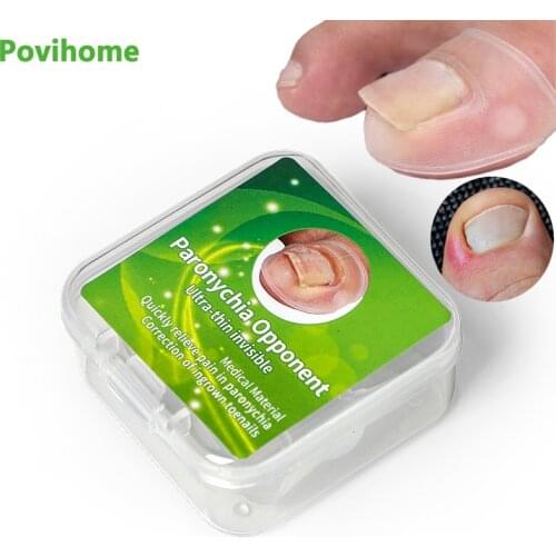 2/4/6pcs Silicone Ingrown Toe Nail Correction Tool Pedicure Nails Care Manicure Paronychia Orthotics Recover Toenails Corrector