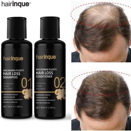 Ginger Hair Growth Products Shampoo Conditioner Set Grow Hair Thickener Hair Scalp Treatments Serum Oil Care For Men Women 200ml
