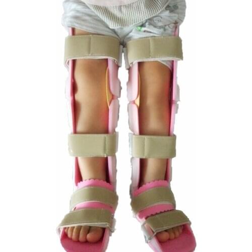 Customized childrens X-shaped O-legs, round legs, orthosis brace internal and external legs orthosis