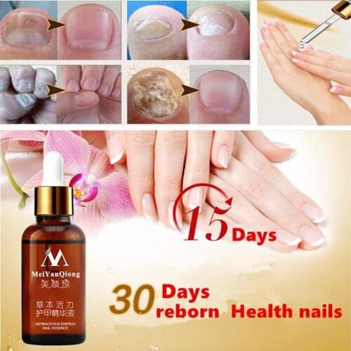 1pc Nail Fungus Treatment Nail Oil Pen Anti Fungal Nail Cuticle Remover Liquid Nail Growth Skin Care Pedicure Tool 30ml TSLM1
