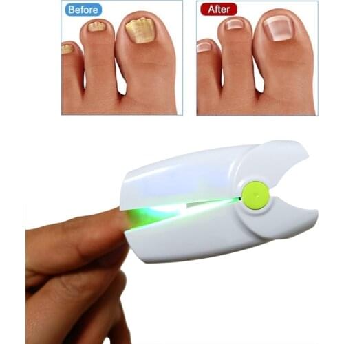 Rechargeable Portable nail laser fungus cold laser nail fungal Infection grey color toenail laser device Nail mushroom treatment