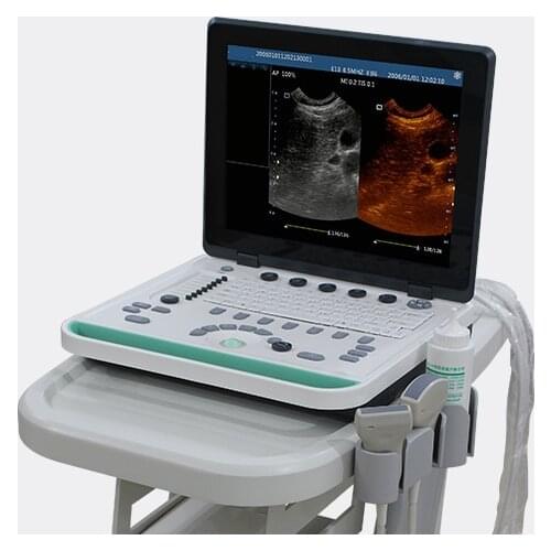15in lcd animal USG 3D notebook PC based with C E