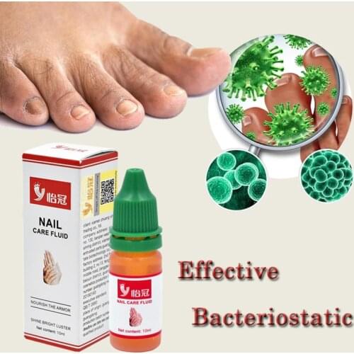 Herbs Fungal Nail Treatment Toe Nail Fungus Removal Gel Feet Care Essence Nail Foot Whitening Bright Anti Infection Dropshipping