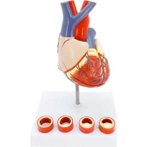 1:1 Human Heart Anatomical Model Authentic Human Heart Anatomical Model with a 4-stage Thrombotic Process
