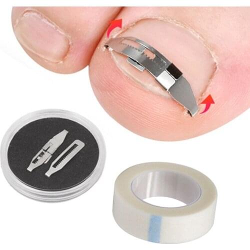Ingrown Toenail Corrector Tools Pedicure Recover Embed Toe Nail Treatment Professional Ingrown Toenail Correction Foot Care Tool