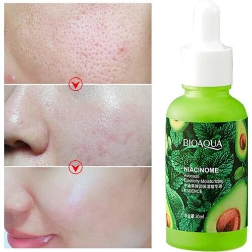 1pcs Avocado Elastic Moisturizing Face Serum Moisturizing Brightening Pore Reduction Refreshing Face Care Essence Cosmetics 30ml