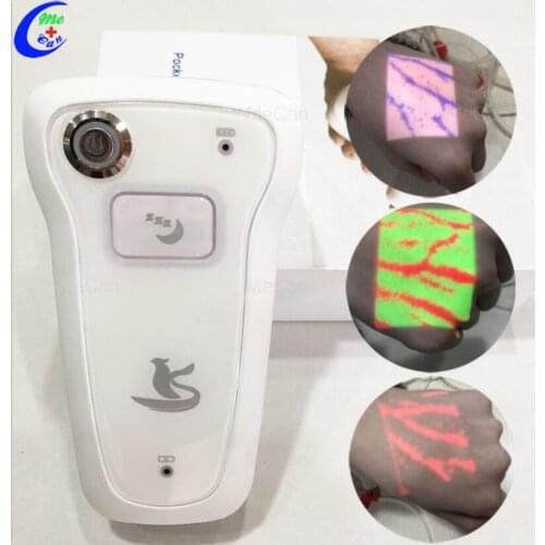 Portable projection near-infrared vascular imaging light puncture-assisted high-definition venous blood vessel display