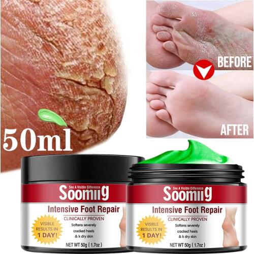 SOOMIIG Foot Care Products