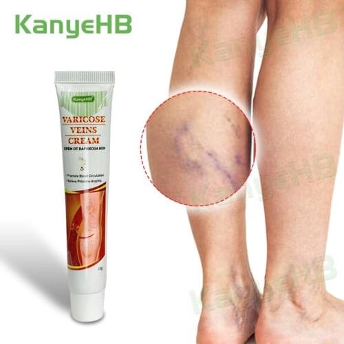 Leg Varicose Ointment Treatment Varicocele Cream Varicose Veins Cream Varicosity Medical Ointment Feet Varicosity Plaster G002