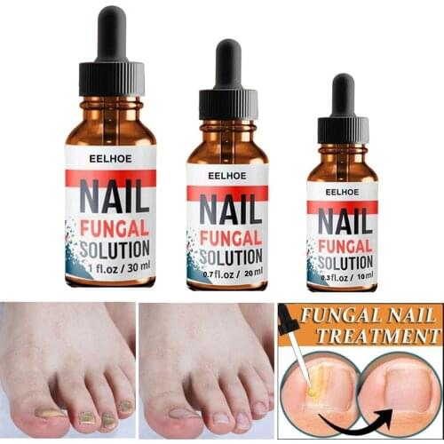 Fungal Nail Treatment Essence Nail Relief Repair Damaged Brittle Nail - Protects nails from external aggression