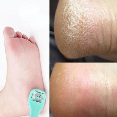 1pc Pedicure Tools Beauty Heel Cuticle Scraper Cutter Tool Blades Peeling Exfoliating File Exfoliating Care Foot Mani M0A9