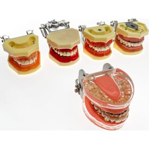 Dental Simulation Model Study Teeth Model Adult Pathological Periodontal disease for Oral Education model