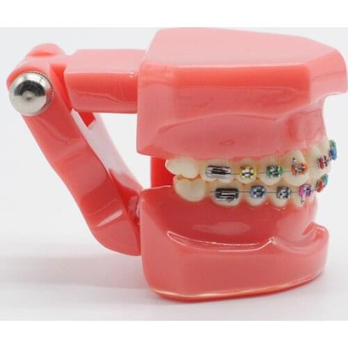 Dentist Orthodontic Mallocclusion Teeth Model With Bracket Archwire Buccal Tube