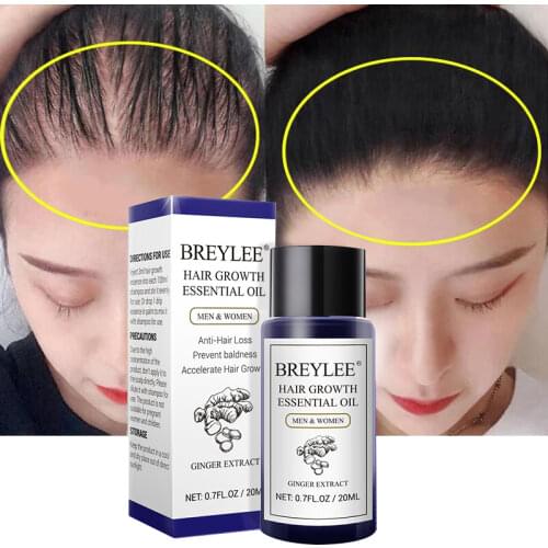 BREYLEE Hair Growth Essential Oil Fast Powerful Hair Products Hair Care Prevent Baldness Anti-Hair Loss Nourishing Serum 20ml
