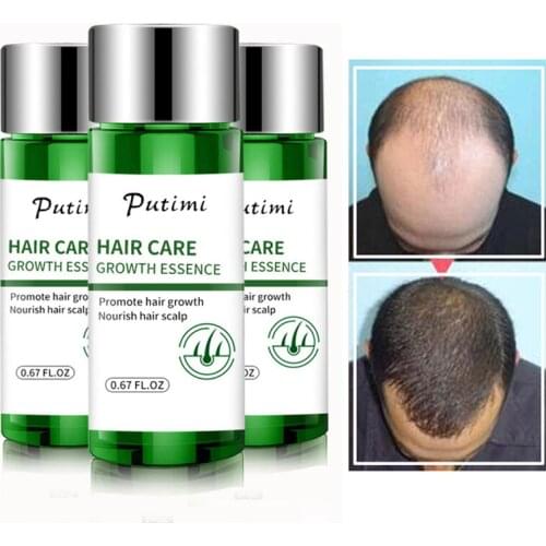 Ginger Hair Growth Essential Oils Promote Hair Regrowth Essence Prevent Baldness Hair Loss Hair Serum Repair Damaged Hair Care