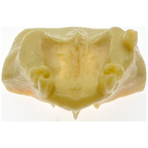 1pc Dental Sinus Lift Practice Teeth Model Typodont Study Model 2013F Model tools