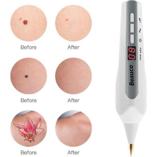 Laser spot Freckle Tattoo Skin Spots Remove Mole Wart Dark Spot Facial Beauty Plasma Pen