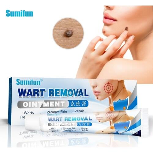Sumifun 20g Body Warts Treatment Cream Skin Care Tag Remover Ointment Herbal Medicine Warts Ointment Foot Corn Removal Plantar
