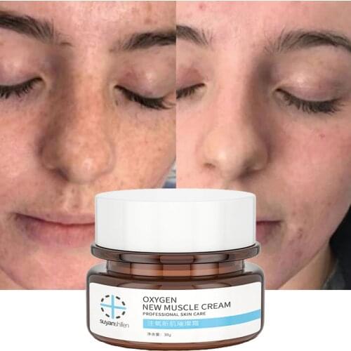 30g Face Cream Remove Freckles Dark Spots Fade Fine Lines Gel Whitening Moisturizing Brightening Facial Skin Care Cream Beauty
