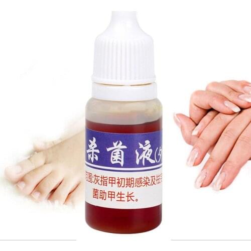 10ml Liquid Nail Repair Pen Onychomycosis Anti Fungal Toe Fungus Treatment Toe Finger Nail Health Accessories TSLM1