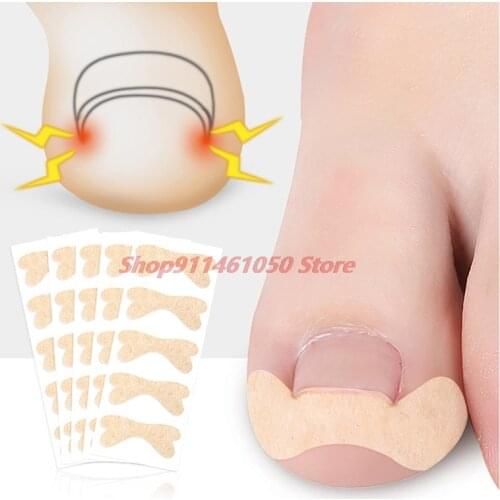 1sheet Ingrown Toe Foot Nail Correction Sticker Pedicure Toenail Corrector