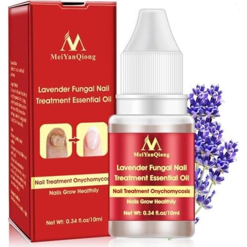 New Chinese Cream Nails Finger Toe Protector Fungus Treatment Herb Health Tools Onychomycosis Paronychia Infection Skin Care