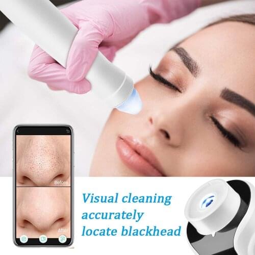 WiFi Visual Face Blackhead Vacuum Suction Pore Cleaner Acne Remover Electric Heating Nose Face Deep Cleansing Microscope Camera